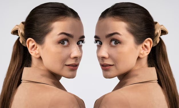 Non-surgical rhinoplasty: Before and after photos showcasing the transformative results of this popular cosmetic procedure.